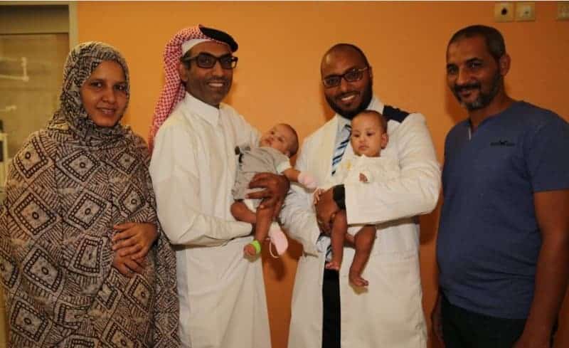 Sidra successfully separates conjoined twins