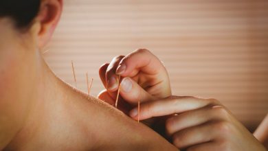 34 HMC physiotherapists receive dry needling certification