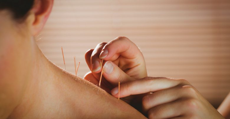 34 HMC physiotherapists receive dry needling certification