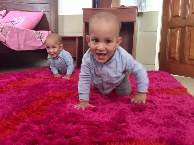 Conjoined twins separated at Sidra to celebrate first birthday in Mali today
