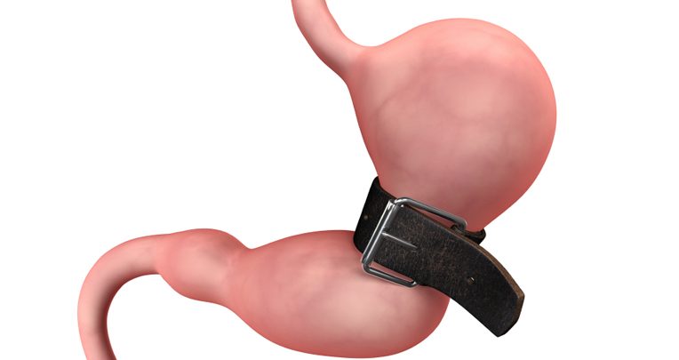 Bariatric surgery: Learn all about its Pros and Cons