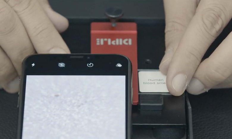 A new innovation that turns your phone into a microscope that can zoom 1000 times