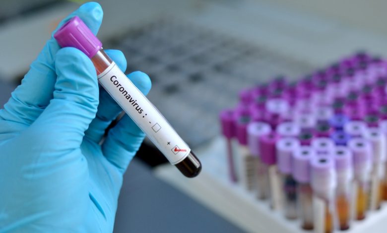 Health ministry declares additional measures on coronavirus
