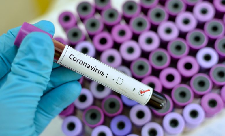 Qatar reports first death from coronavirus; 28 new cases