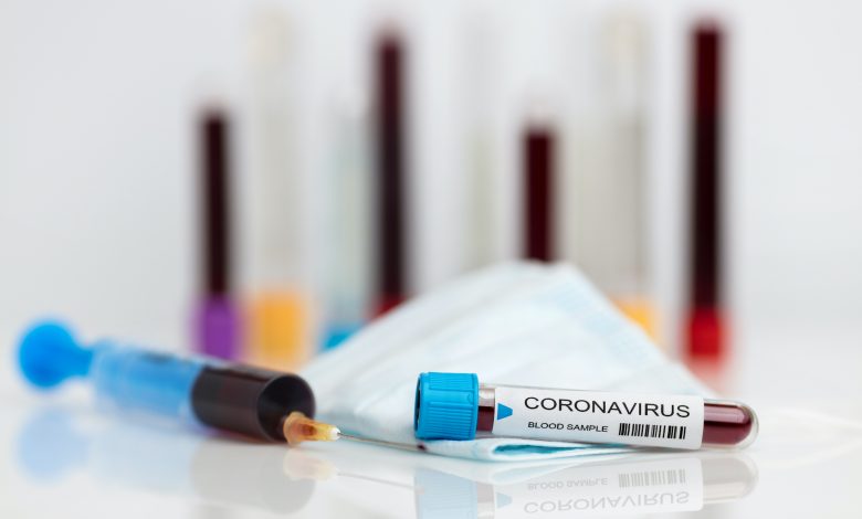 MoPH reports 38 new confirmed cases of coronavirus 2019 (COVID-19) in Qatar