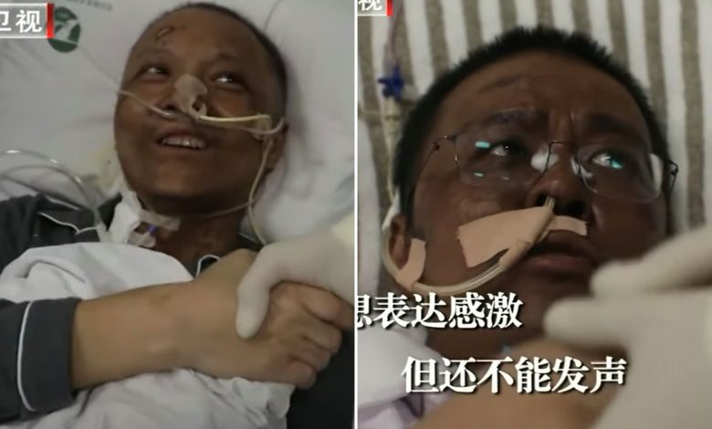 Wuhan doctors wake from fighting coronavirus to find skin has changed colour