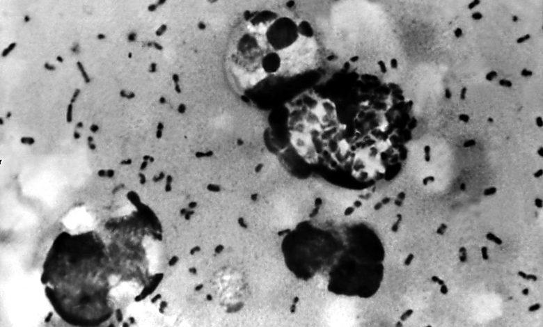 What is bubonic plague, aka ’black death’, reported in China?