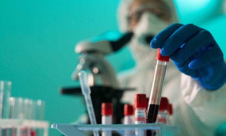 Should antibody tests be undergone after Coronavirus vaccine?