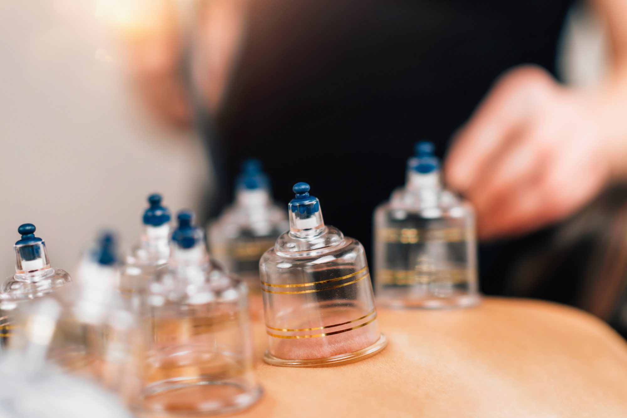Truth of the rumors about cupping and the Covid vaccine