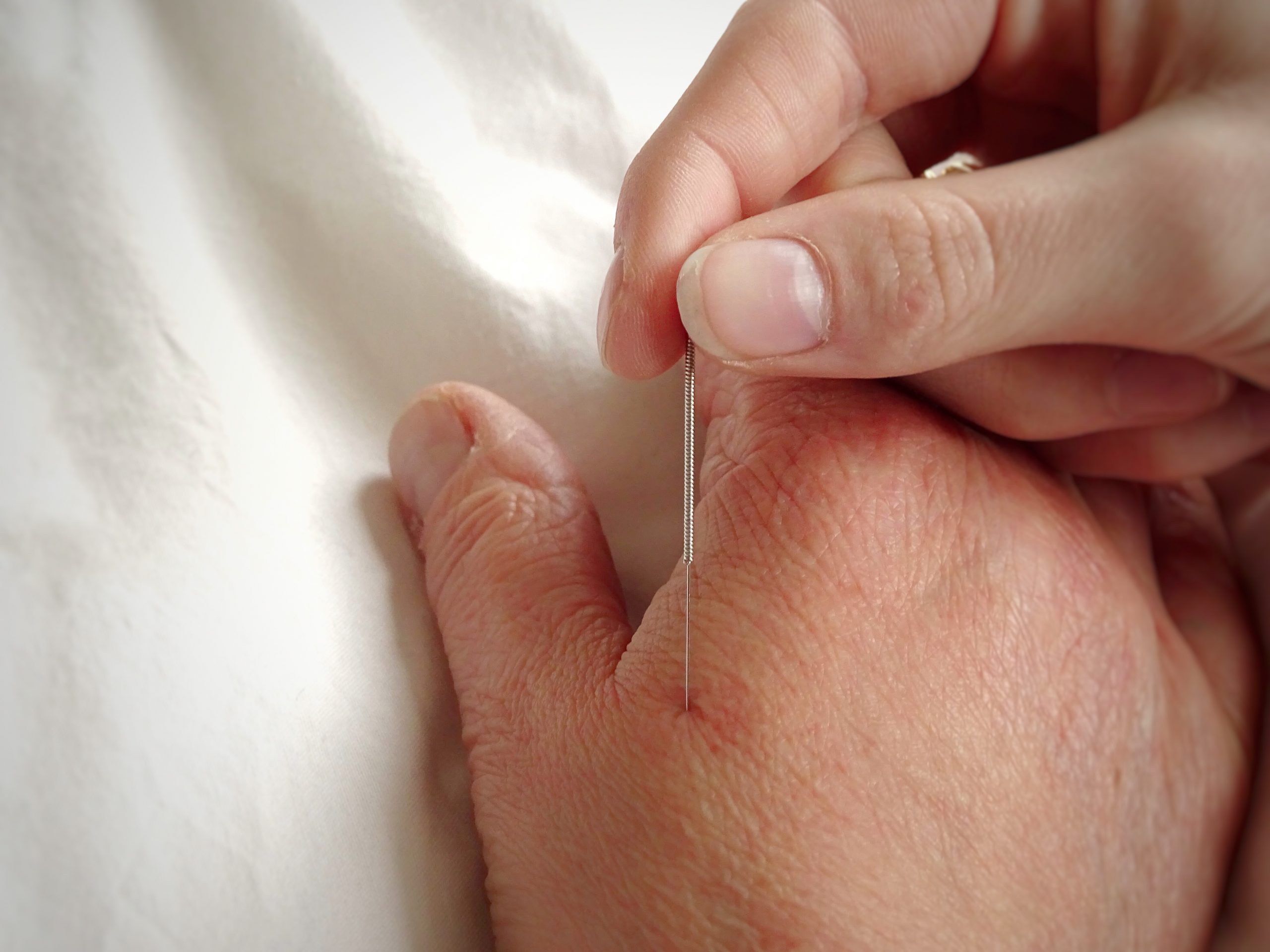 MoPH Updates Acupuncturist Licensing Requirements