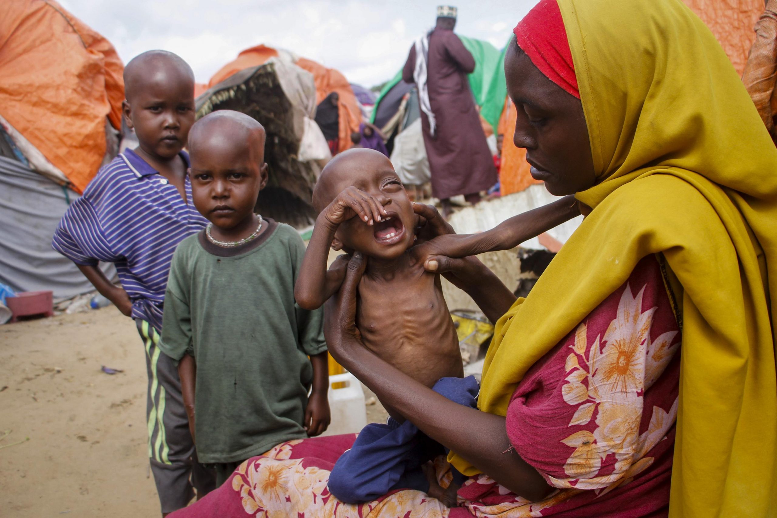 UNICEF: Hundreds of Children Have Died of Starvation in Somalia